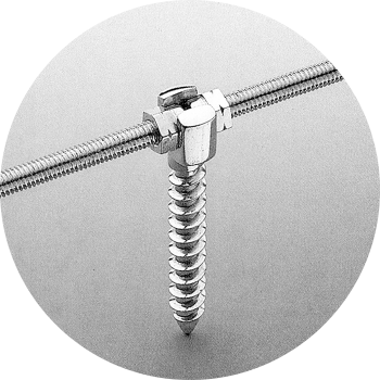 © Ulrich Medical. Todos los derechos reservados. Queda prohibido el uso, la reproducción o la distribución sin autorización expresa. © Ulrich Medical. Todos los derechos reservados. Queda prohibido el uso, la reproducción o la distribución sin autorización expresa.