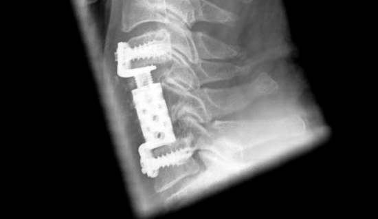 © ulrich medical. All rights reserved. Use, reproduction or transfer without express authorization is not permitted. © ulrich medical. All rights reserved. Use, reproduction or transfer without express authorization is not permitted.